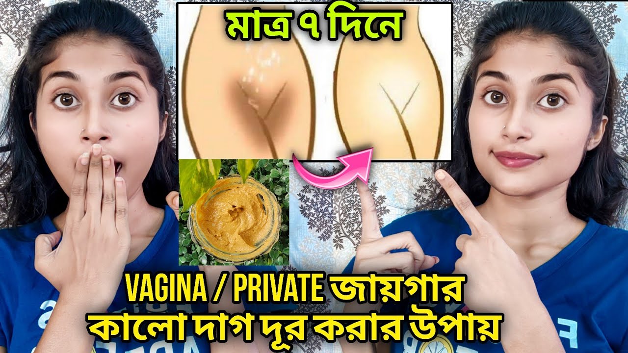 শরীরের-গোপন-স্থানের-কালো-ছোপ-দূর-করার-উপায়